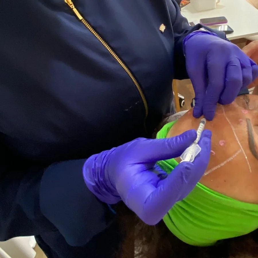 Aplicação de Toxina em Guarulhos - Estética Silvana Araújo