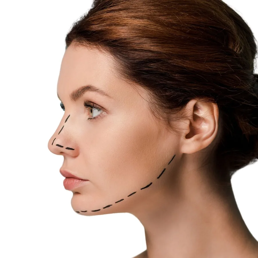 Perfiloplastia em Guarulhos