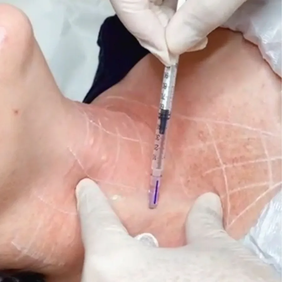 Skinbooster em Guarulhos